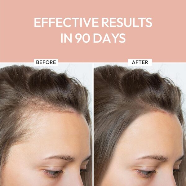Luxe Cosmetics Hair Growth Serum - Image 5